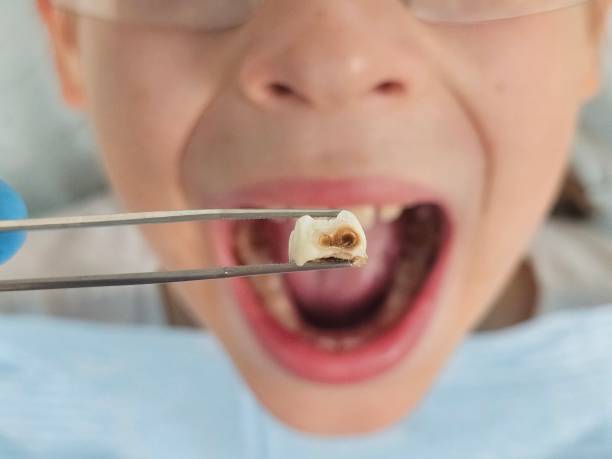 Best Broken or Chipped Tooth Repair in Edenton, NC